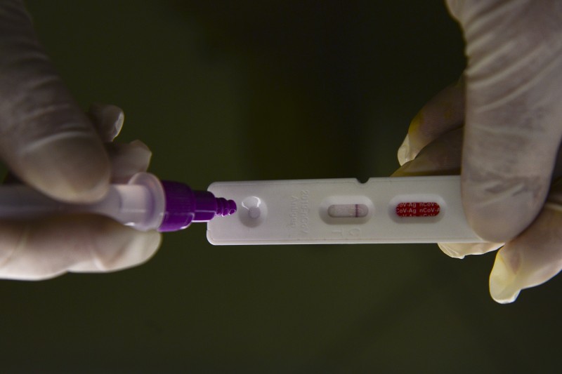 Brasil registra 5.986 novos casos de covid-19 em 24 horas